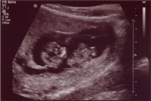 baby1